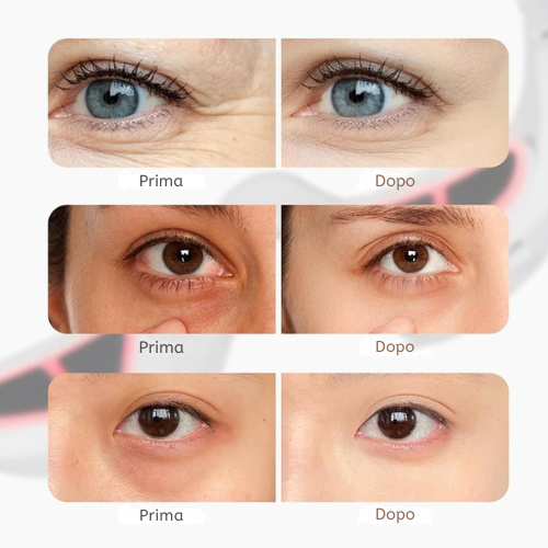 Illumina EyesLift Pro™